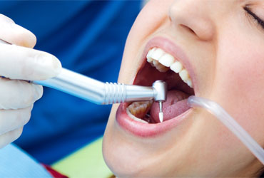affordable-root-canal-treatment-in-panvel-vicahre-dental-clinic